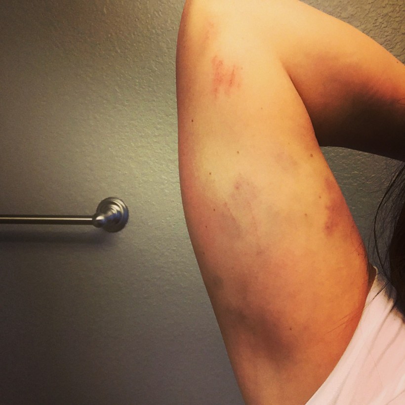 Yeah I felt different, alright. If by "different" you mean full of bruises. Ouch. 